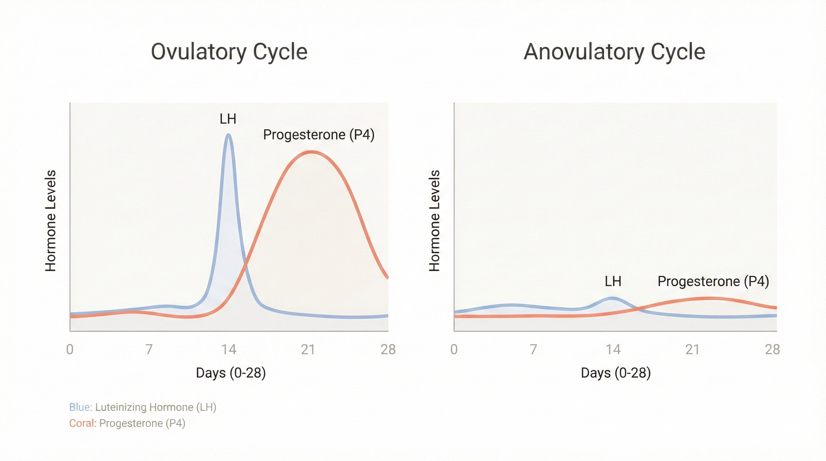 Medical chart comparing hormone levels in a normal ovulatory cycle versus a flat line in an anovulatory cycle.